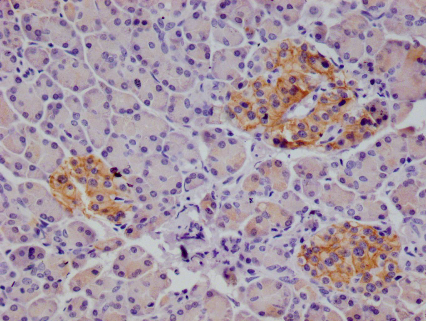 CSB-RA437652A0HU
