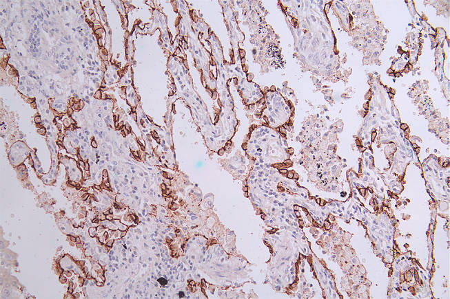 CSB-RA548145A0HU