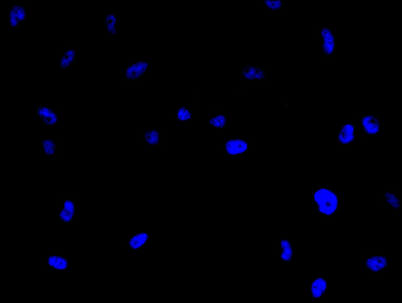 CSB-RA555745A0HU