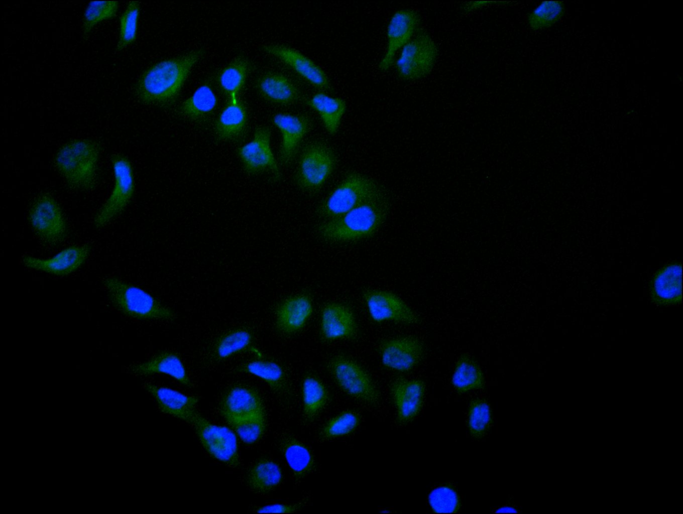 CSB-RA555745A0HU