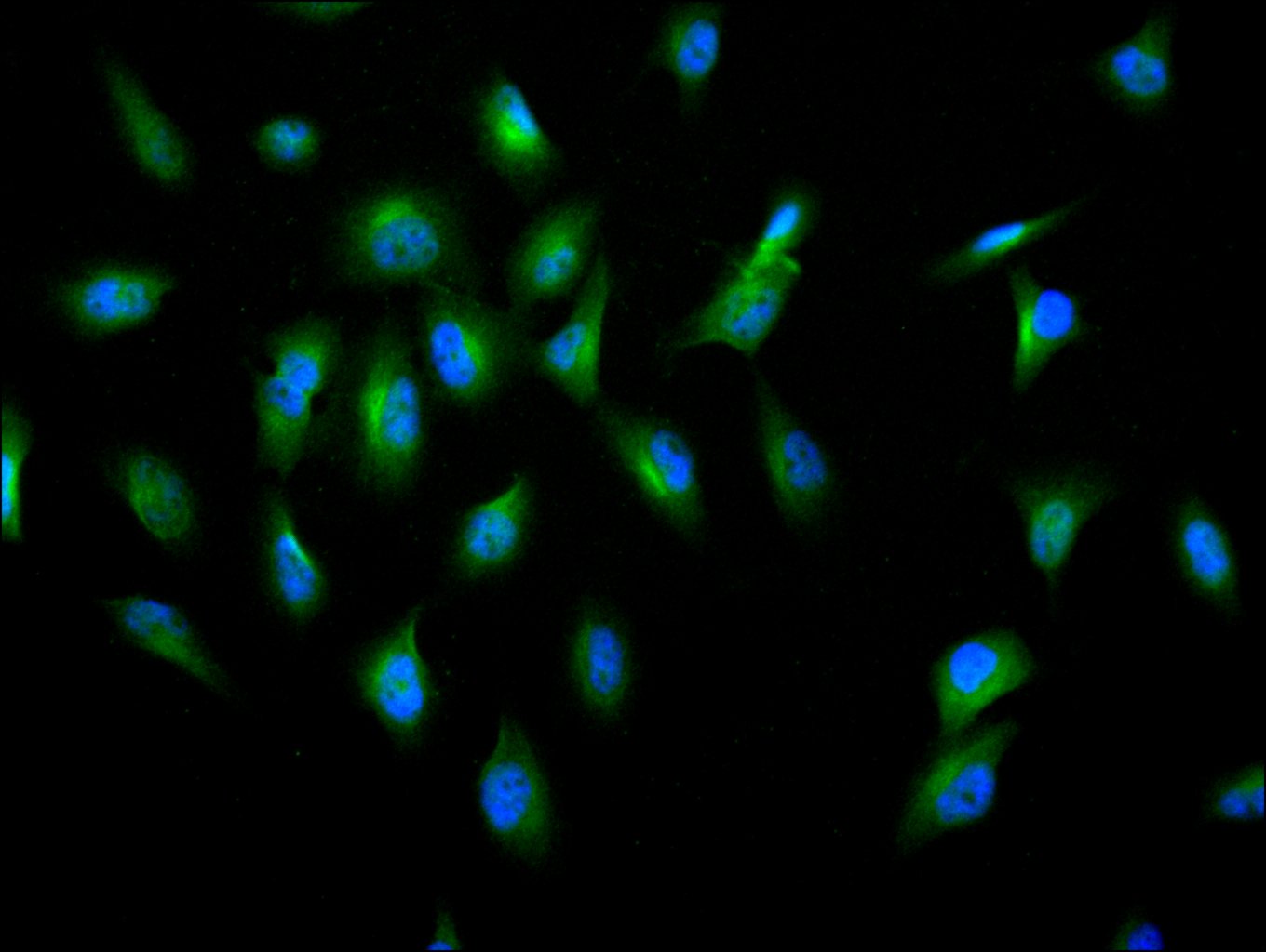 CSB-RA555745A0HU