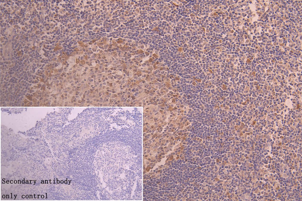 CSB-RA555745A0HU