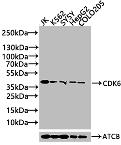 CSB-RA555745A0HU