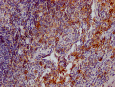 CSB-RA567010A0HU