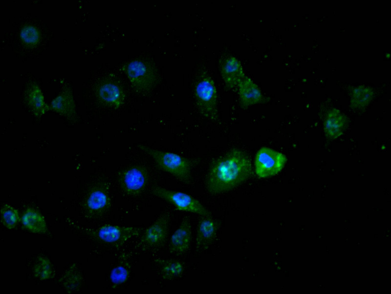 CSB-RA571090A0HU