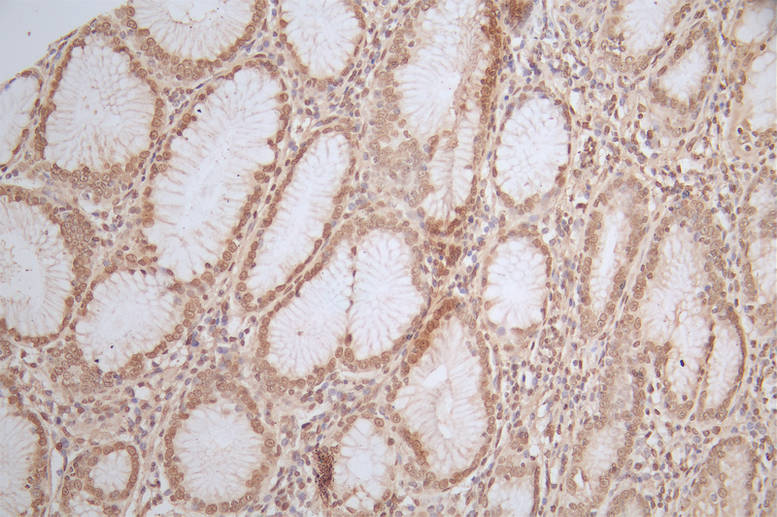 CSB-RA571090A0HU