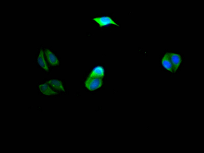 CSB-RA578819A0HU
