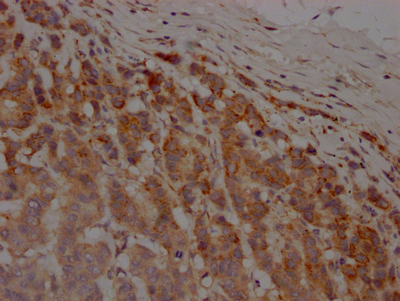 CSB-RA595609A0HU