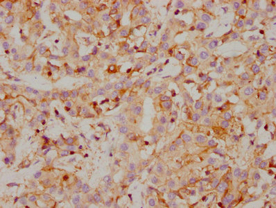 CSB-RA614990A0HU
