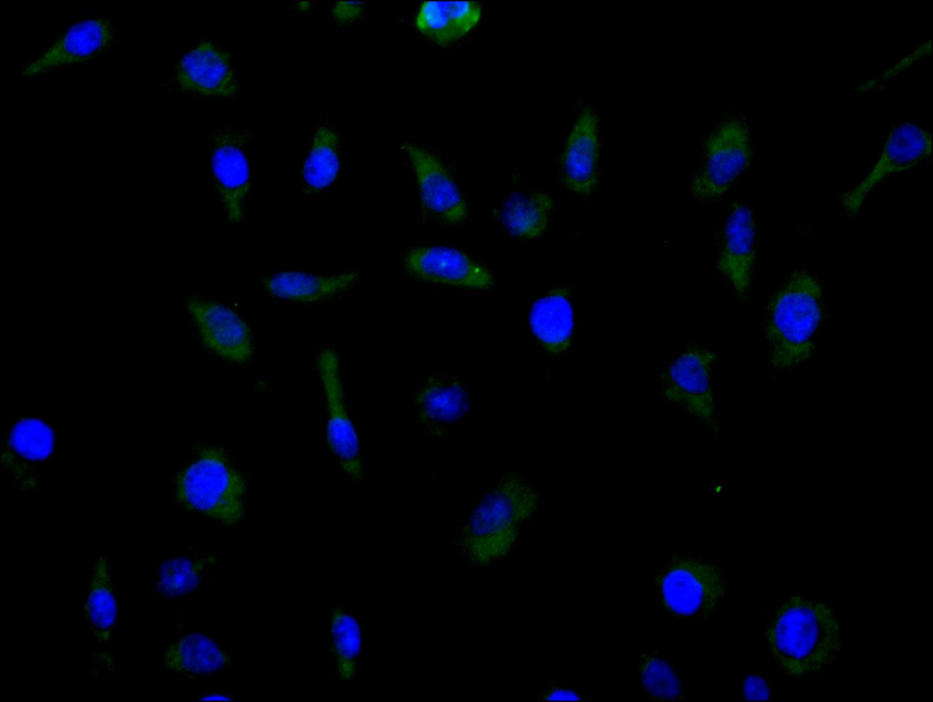 CSB-RA620892MA1HU