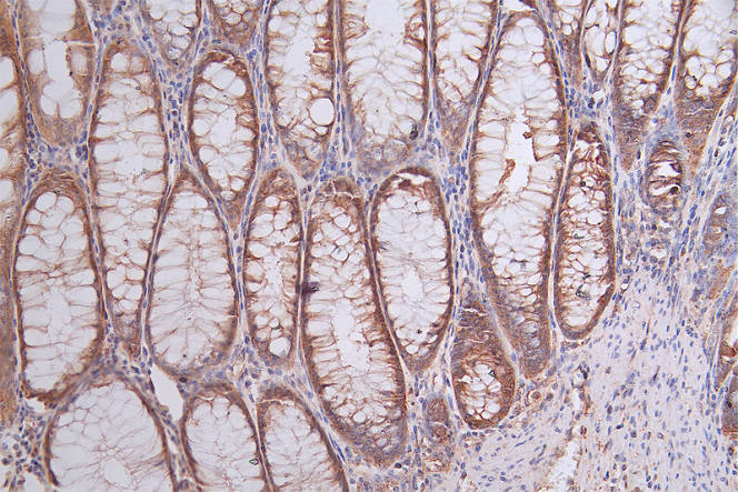 CSB-RA644510A0HU