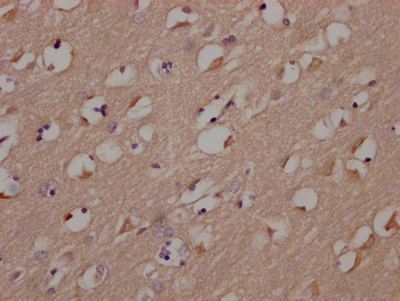CSB-RA699767A0HU
