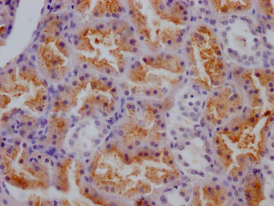 CSB-RA788455A0HU
