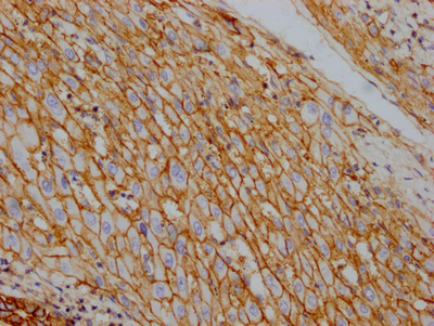CSB-RA796310A0HU