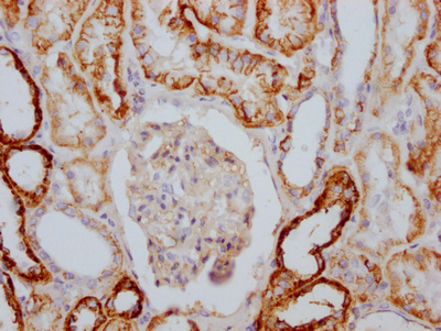 CSB-RA796310A0HU