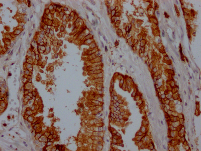 CSB-RA796695A0HU