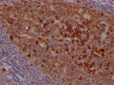 CSB-RA796695A0HU