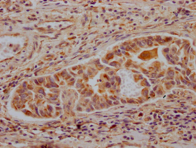 CSB-RA799763A0HU