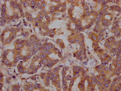 CSB-RA847116A0HU
