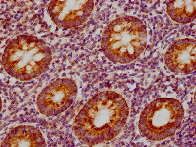 CSB-RA859522A0HU