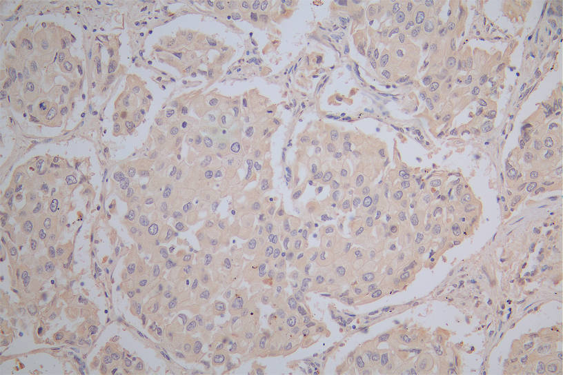 CSB-RA878942MA1HU