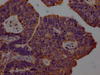 CSB-RA903061A0HU