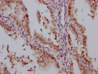 CSB-RA906662A0HU
