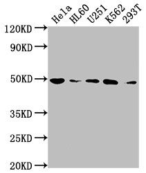 CSB-RA906662A0HU