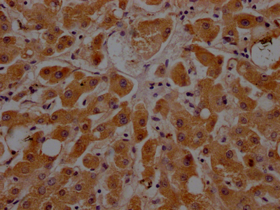 CSB-RA925915A0HU