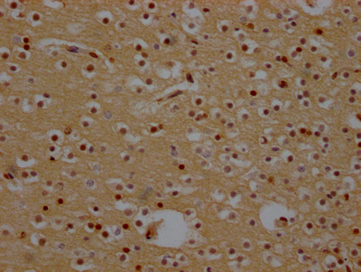 CSB-RA930964A0HU