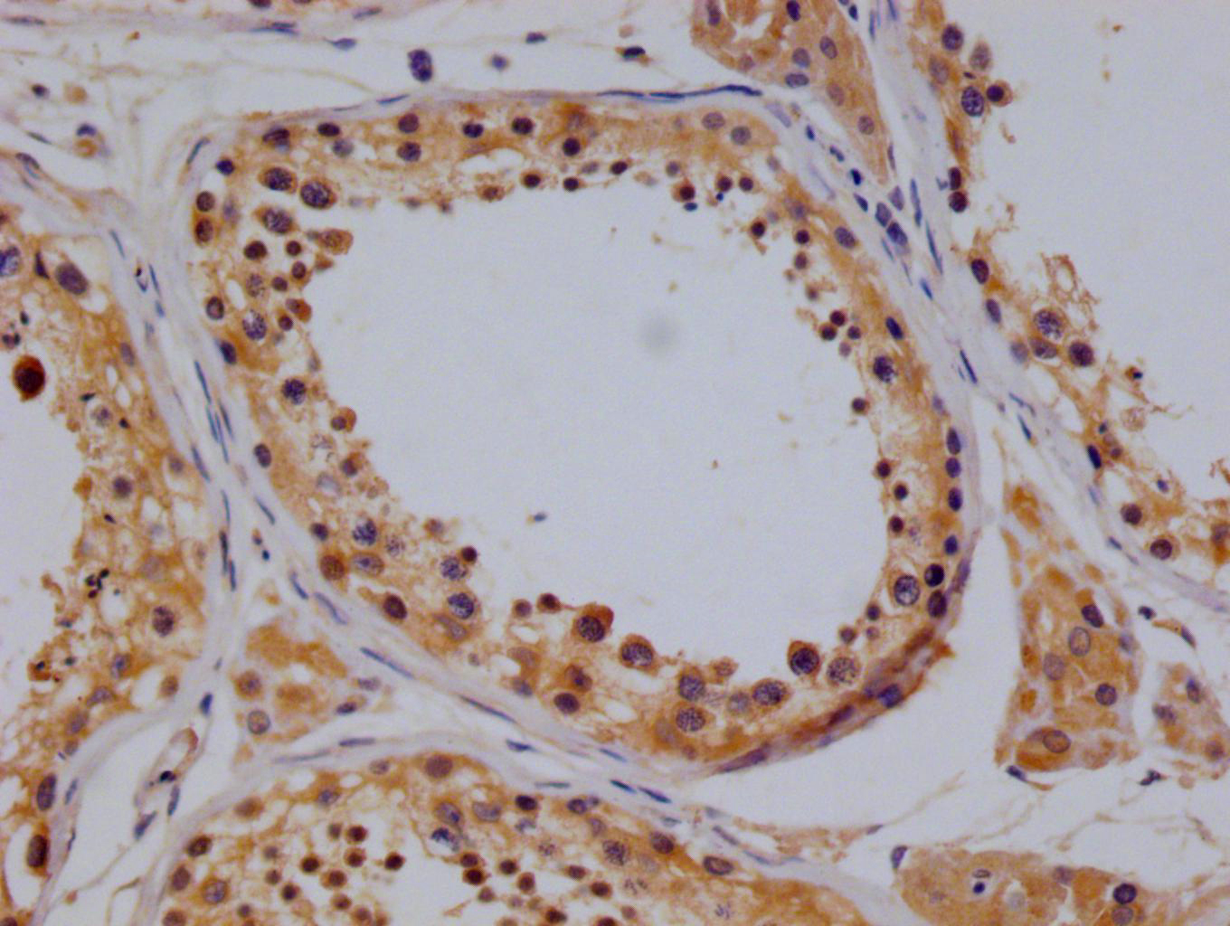 CSB-RA932866A0HU