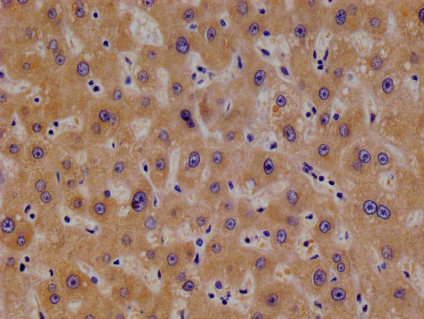 CSB-RA932866A0HU
