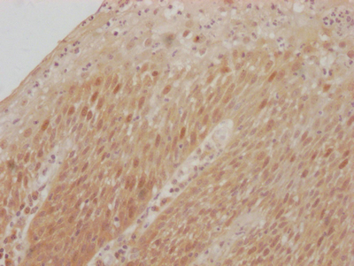 CSB-RA961467A0HU