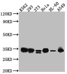 CSB-RA961467A0HU