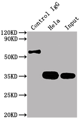 CSB-RA965615A0HU