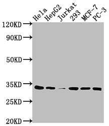 CSB-RA965615A0HU
