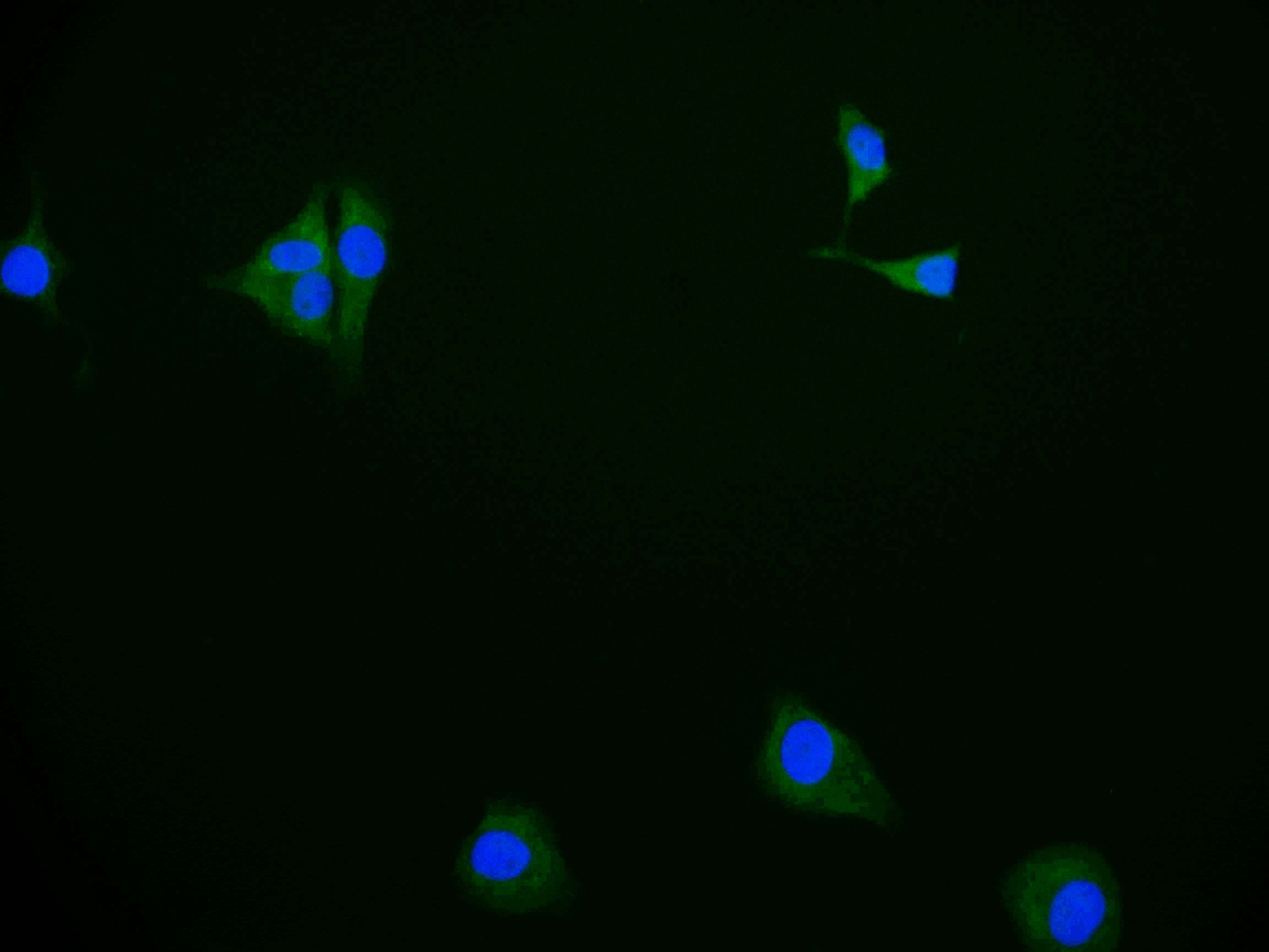 CSB-RA983422A0HU