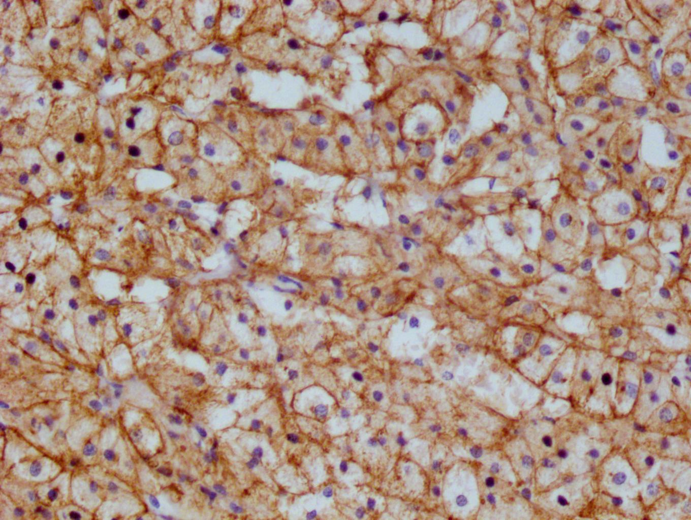 CSB-RA983422A0HU