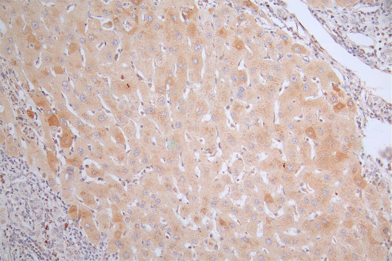 CSB-RA988767A0HU