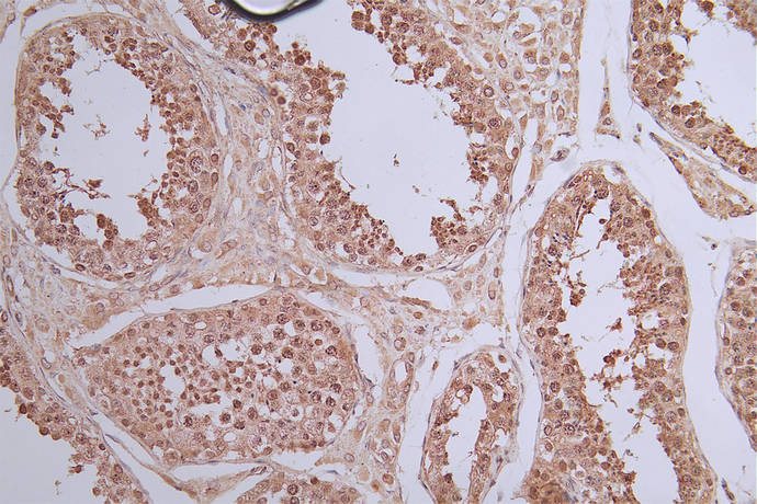 CSB-RA989713A0HU