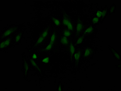 CSB-RA995655A0HU