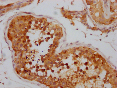 CSB-RA995655A0HU