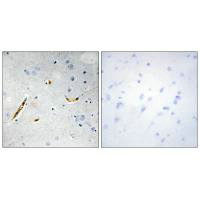 CSB-PA079787