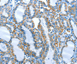 CSB-PA093012