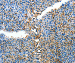 CSB-PA093012
