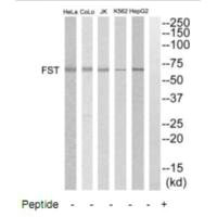 CSB-PA213171