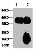 CSB-MA000190