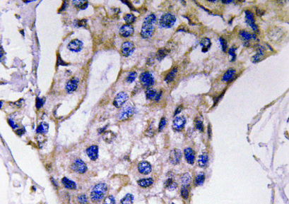 CSB-PA003033