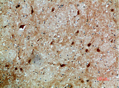 CSB-PA206653