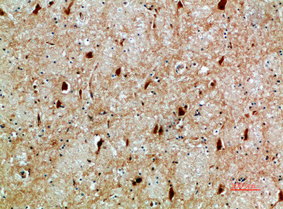 CSB-PA206653